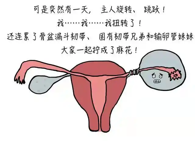 花季少女卵巢囊肿蒂扭转妇科微创手术解危机