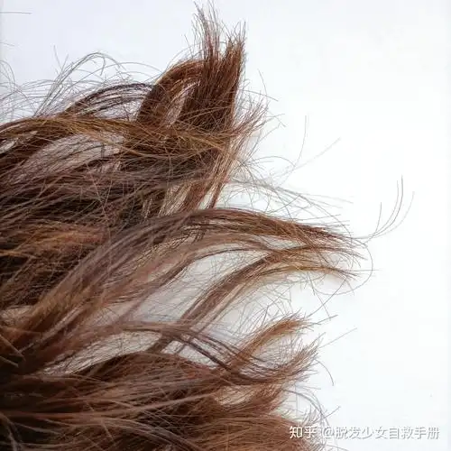 头发干枯毛躁怎么办