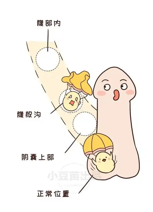 睾丸|包茎|隐睾|隐睾症_网易订阅