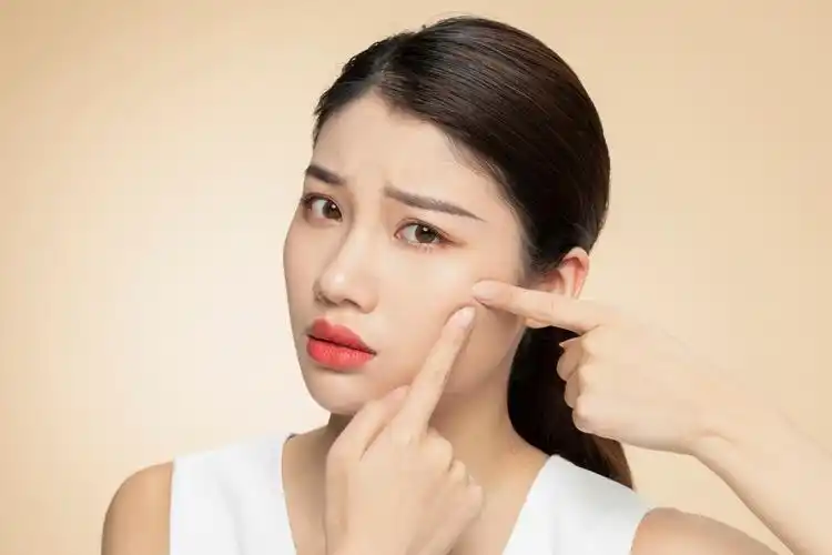 挤痘痘会引起颅内感染吗