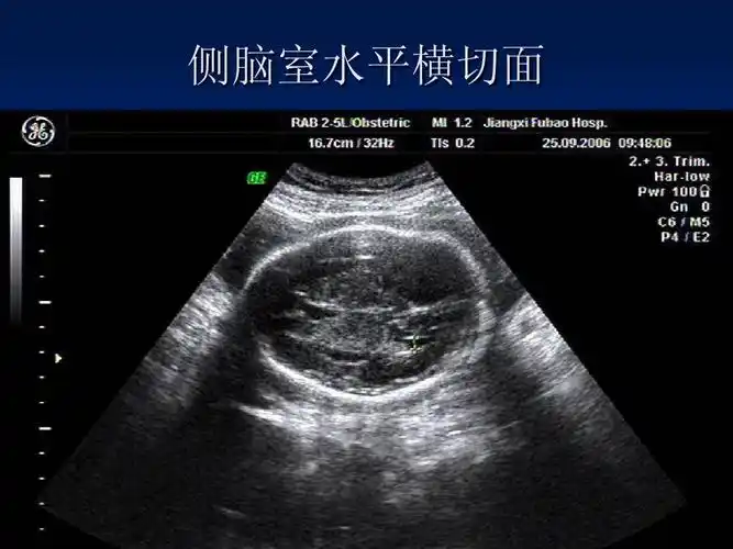 无忧文档 所有分类 医药卫生 临床医学 产科超声技术操作规范ppt 第7