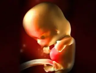 怀孕8周怀孕八周胎儿图怀孕8周反应及胎儿发育情况