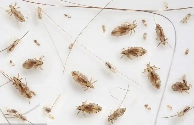 虱子是如何产生的