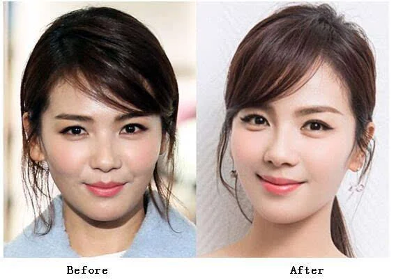原本就是"元宝嘴"的邱莹莹改了wave唇看起来人变得温婉气质多了,怪不