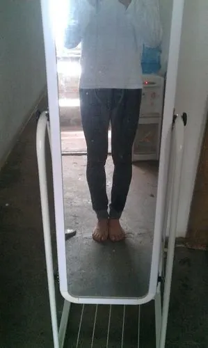 这样的o型腿算什麽程度,很严重吗?我是男生