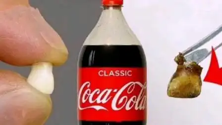 长期喝可乐,牙齿会被腐蚀掉吗?老外亲测测试