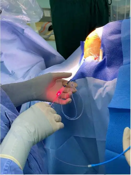 贾旺介绍,激光消融术治疗脑肿瘤或脑转移瘤,对于病灶的大小,部位有