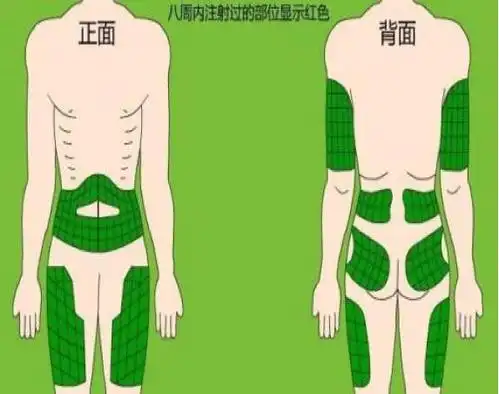 小小肚皮针学问知多少