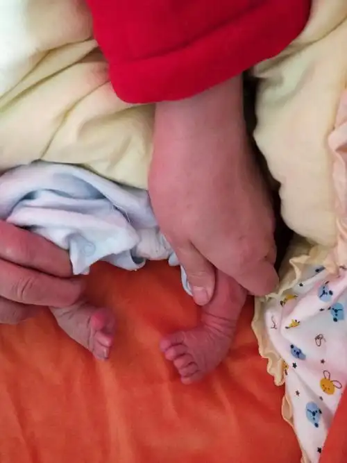 大家帮我看看,孩子出生才5天,脚内翻的,不知道怎么办,请路过,留下意见