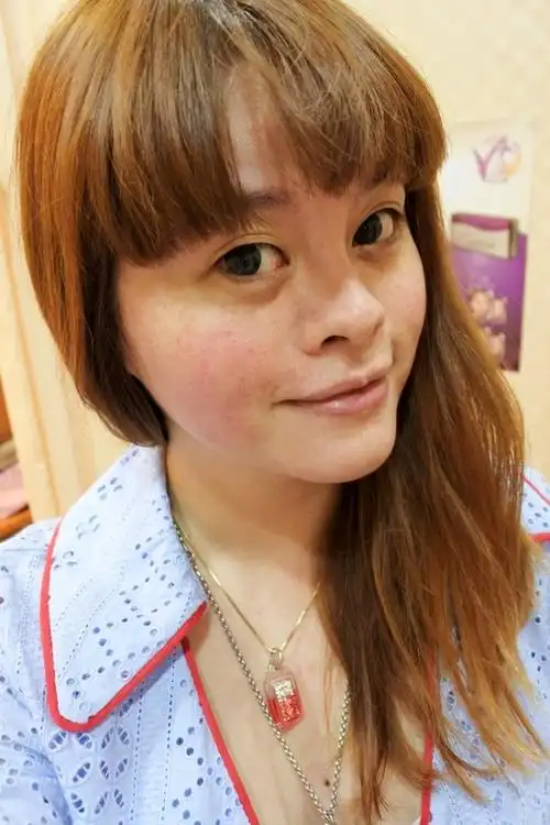 [保养]再见/再也不见--恼人酒糟肌byebye全纪录@京砚联合诊所