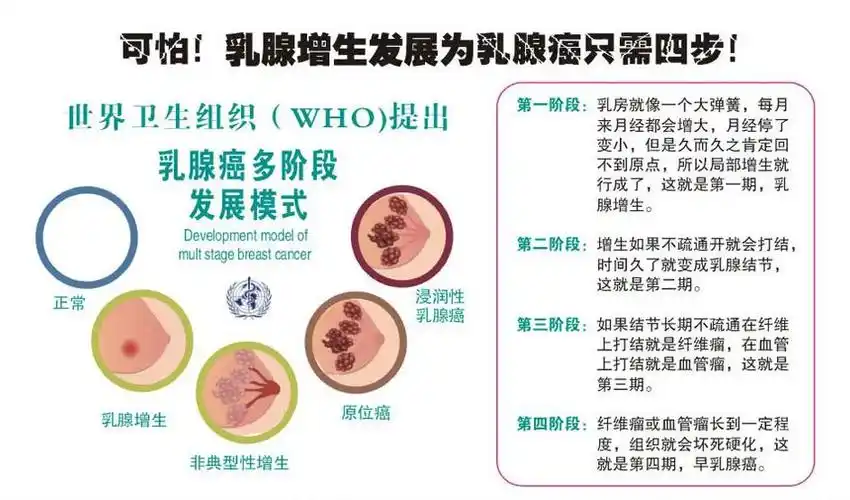 通则不痛"对于乳腺增生引发的乳腺疼痛,其本质是由于乳腺增生腺体导致