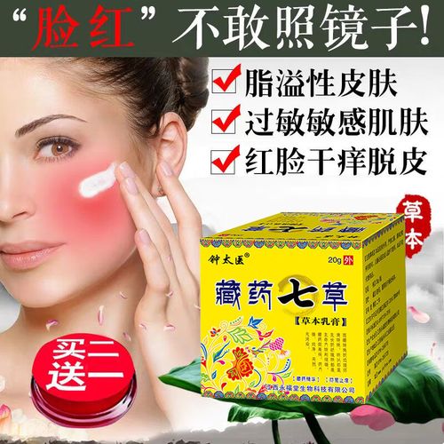 脂溢性皮炎面部治疗脸部发红出油过敏头皮无外用软膏素外用软膏