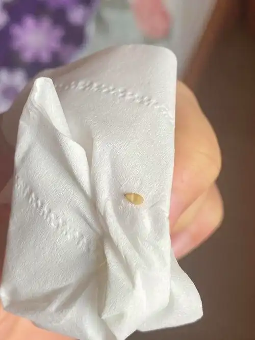 讨论这个是绦虫节片吗