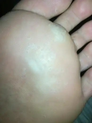 脚底前半部分长蜂巢式的小洞