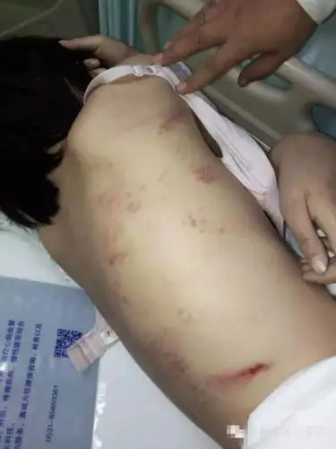 又见校园暴力!少女遭舍友围殴5小时