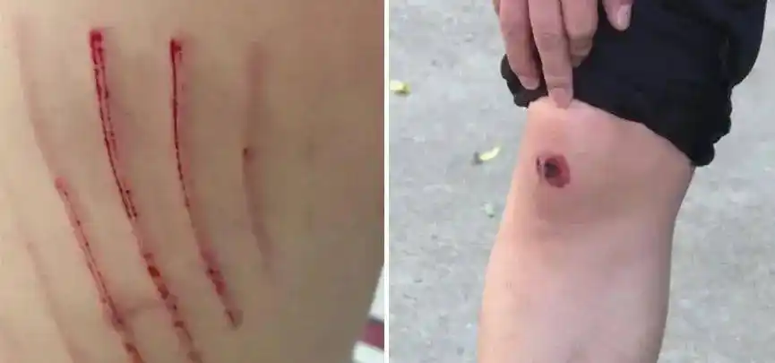 【正能量】老人滚落扶梯,男子16秒神速救人,自己却伤痕累累