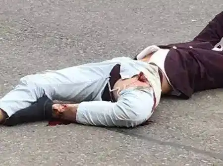 高邮郭集发生的车祸,骨头被都撞出来了!