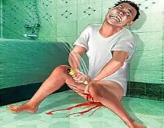 男子与妻闹婚变自宫 人生低谷便企图自杀(图)