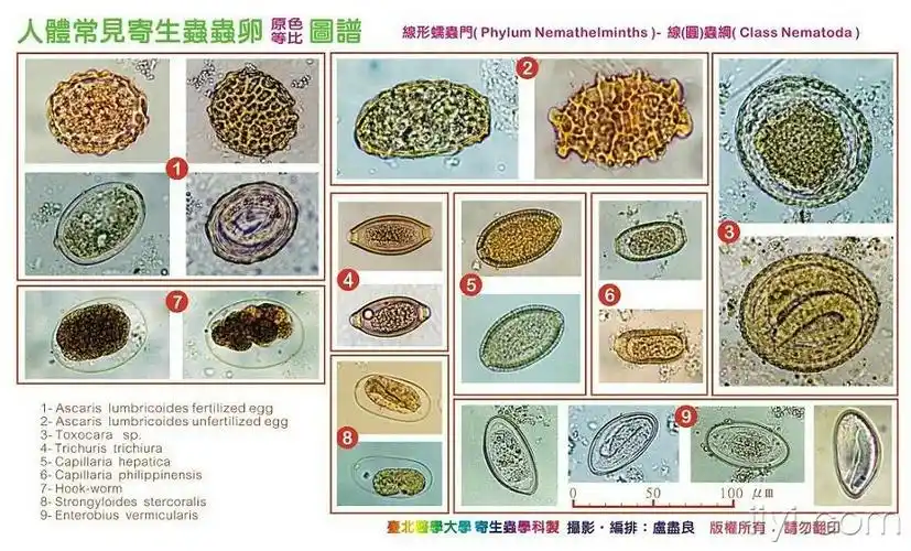 台北医学大学精美寄生虫虫卵图(超清晰)
