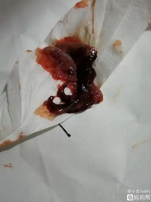 哪家好!怀孕出血"沟通解决"-第1张图片-海风博客