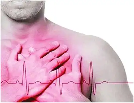 心梗,即心肌梗死.