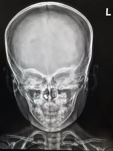 看病也能按加速键检查手术做快车