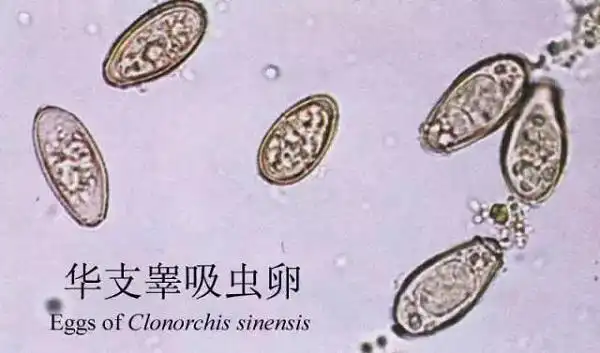 图说:华支睾吸虫卵  来源/来自网络绦虫是什么?