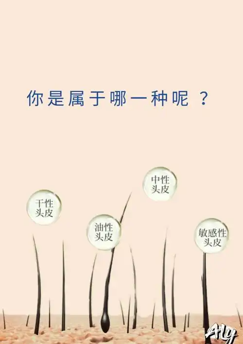 我是属于属于中性头皮 ,你呢 ?