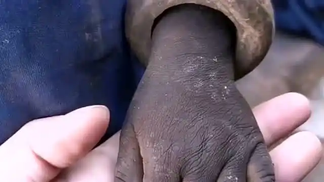 非洲疫情期间,黑人小孩骨瘦如柴,哪个父母看了不心疼!