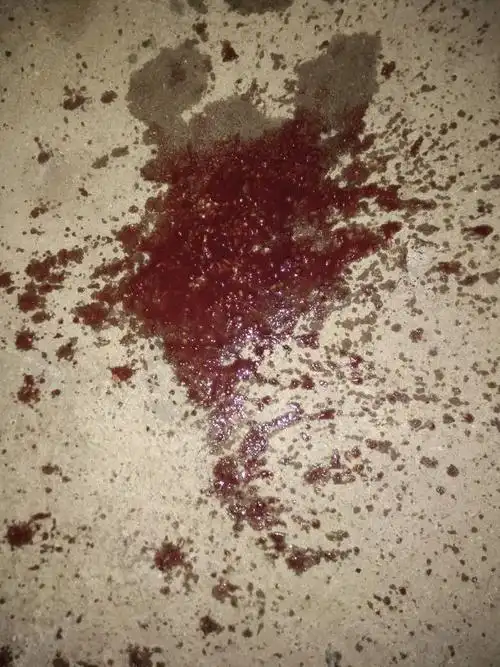 狗狗从昨天开始不吃东西,今天早上呕吐,叫兽医打了一针,晚上就拉血了