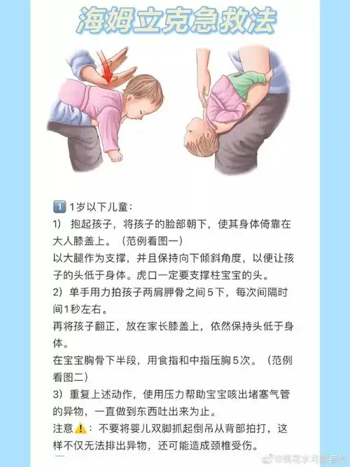 海姆立克急救法