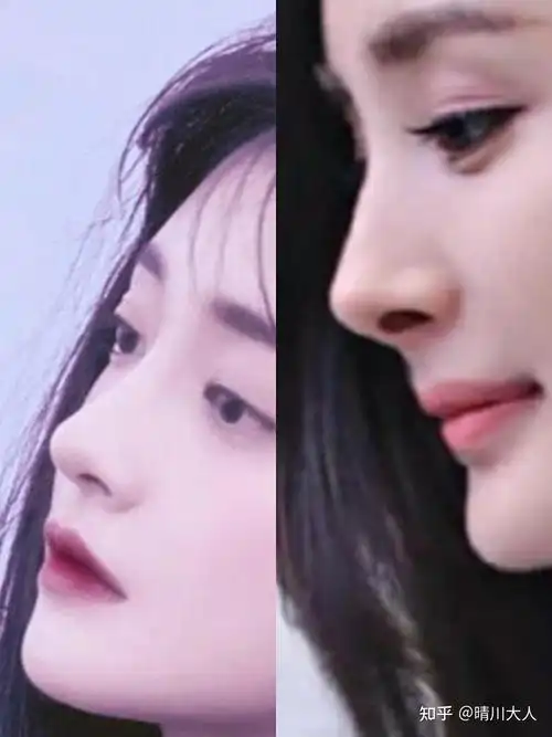 北京哪里做隆鼻比较好呀,求推荐?