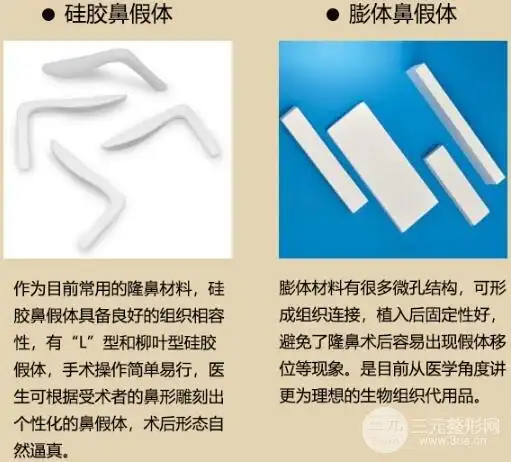 想知道膨体隆鼻手术多少钱?戳进来!