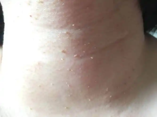 私处长小肉粒(私处长肉粒是在哪里长的)