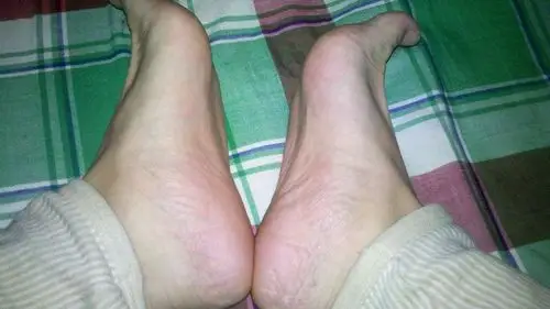 一般来说,人的脚板底板下有一个足弓,也就是脚心的凹槽.