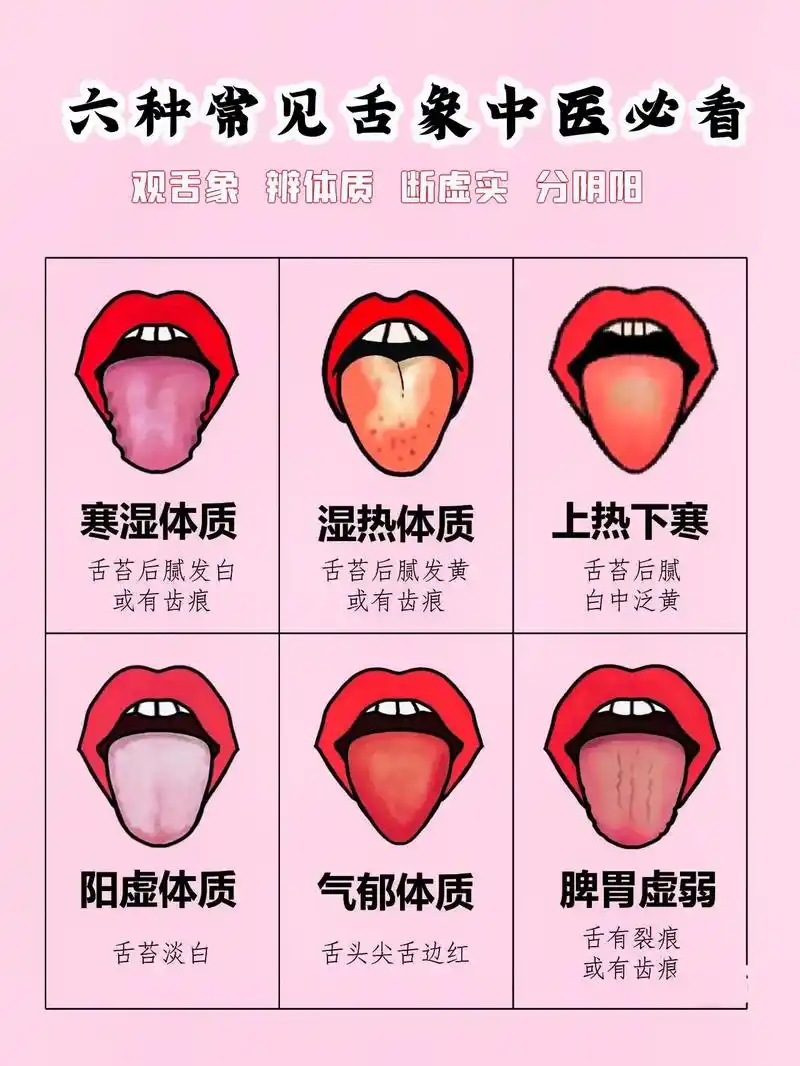 通过舌苔的颜色,状态看看你现在的状态,天 - 抖音