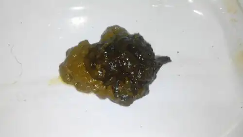 大便黑色怎么办 经常这样.