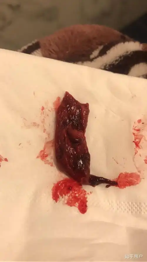 为什么子宫内膜脱落是以血的形式而不是血块?