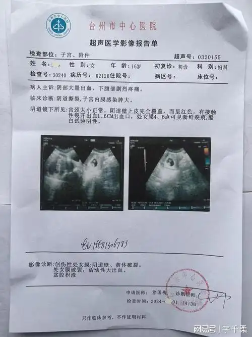 怀孕两周多了突然出血去做了检查下面是报告单刚测出怀孕血值正常