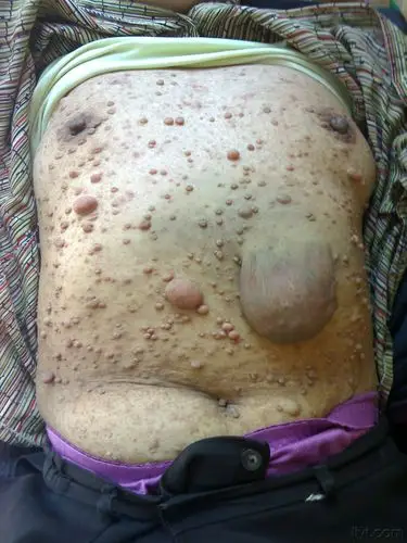 罕见的病例【图】请版主尽快给解答!谢谢