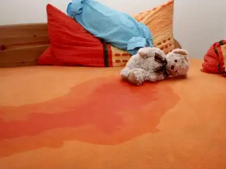 90后美女多年来夜间频尿床害怕被发现天天上夜班