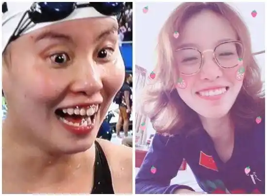 傅园慧拆牙套秒变瓜子脸 网友惊艳直呼"我恋爱了"