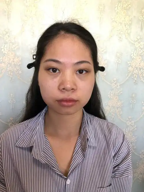 梨型脸新娘改造