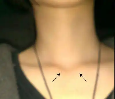 脖子下这两块凸起来的骨头是什么