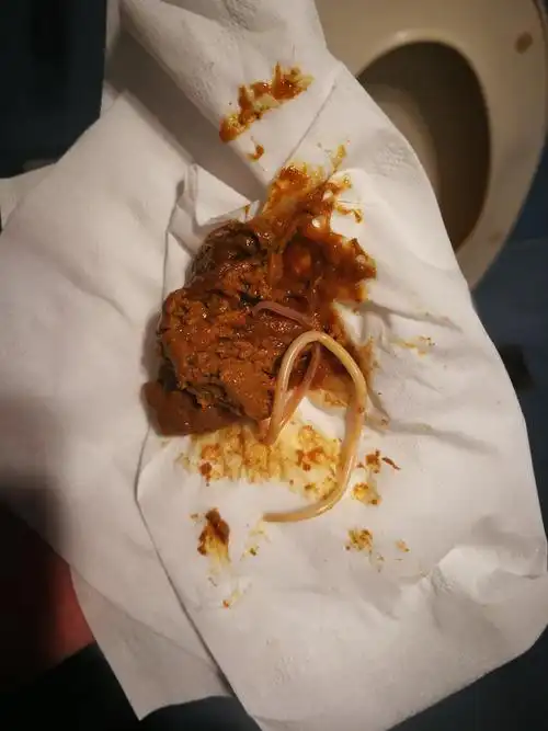 买点驱虫药给它吃   必败无疑哟 | 发布于今天 19:09  评论  是蛔虫