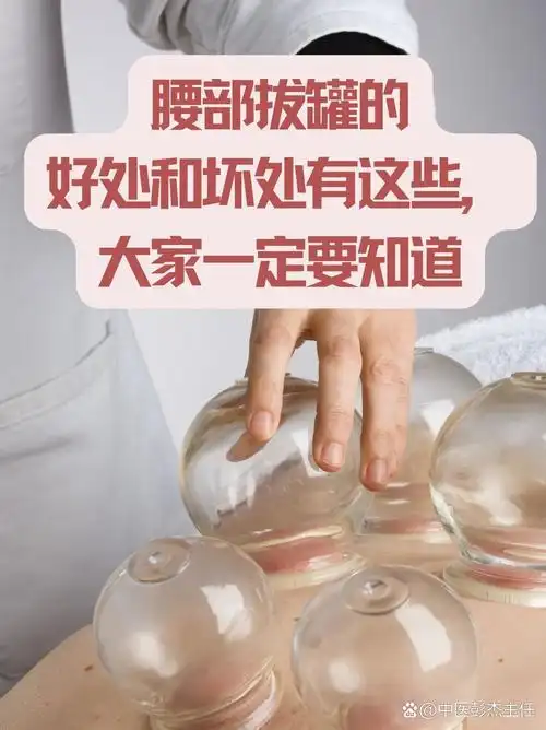 腰部拔罐的好处和坏处有这些,大家一定要知道 拔罐是中医常用的治疗
