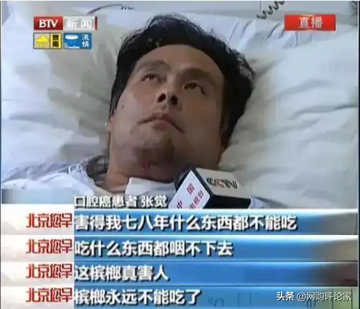 03 正文43岁的刘桑果,因为常年嚼槟榔,他不幸患了口腔癌,他的左脸