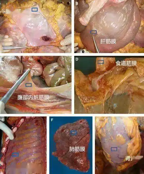 如果疼痛一直难以解决会不会是内脏筋膜出了问题