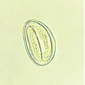 教学资源 实验教学教案 人体寄生虫学实验指导           蛲虫卵