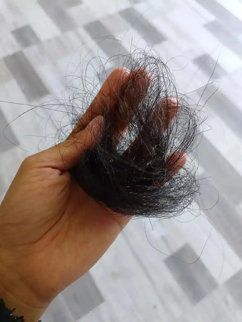 还没有脱贫就开始脱发了,今年的头发掉到怀疑人生,怎么不焦虑呢!